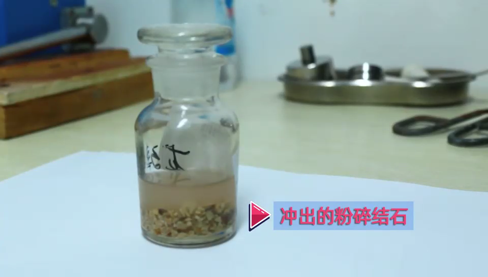 一次解决近7公分巨大结石，她说：常主任像第二个白求恩，希望他的医术名扬四海(图3)