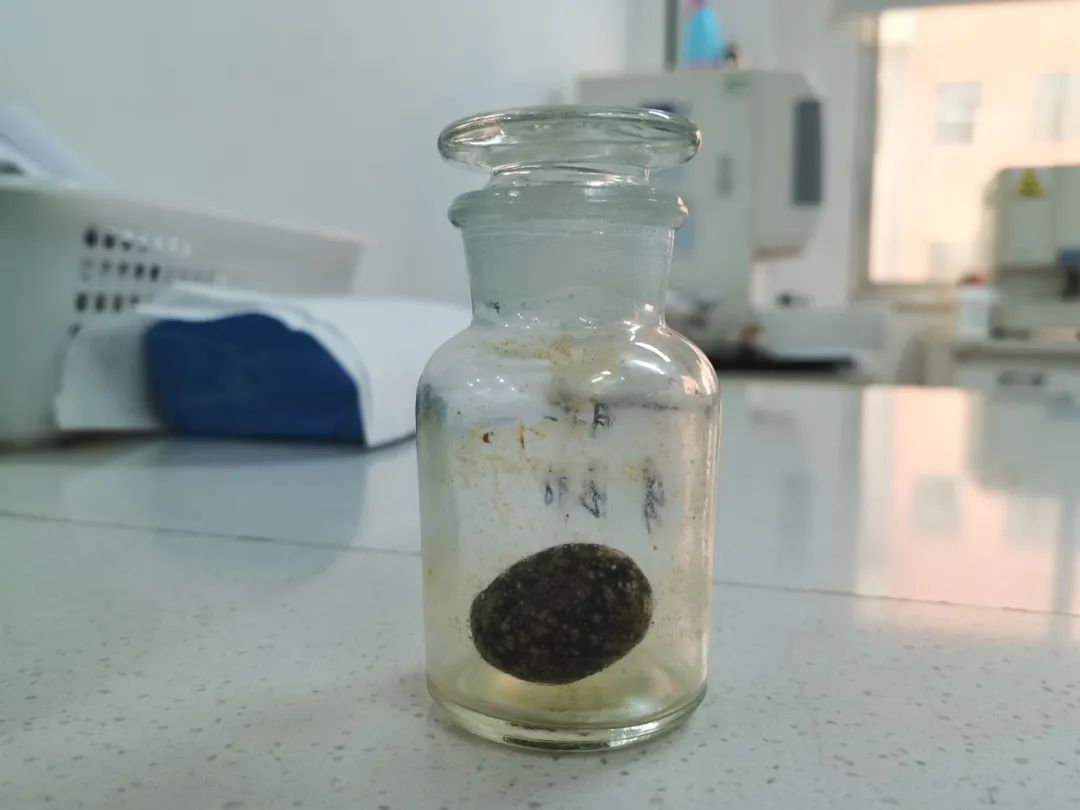 口碑见证！看到亲人们手术效果后，他也选择来四川结石病医院治结石(图1)