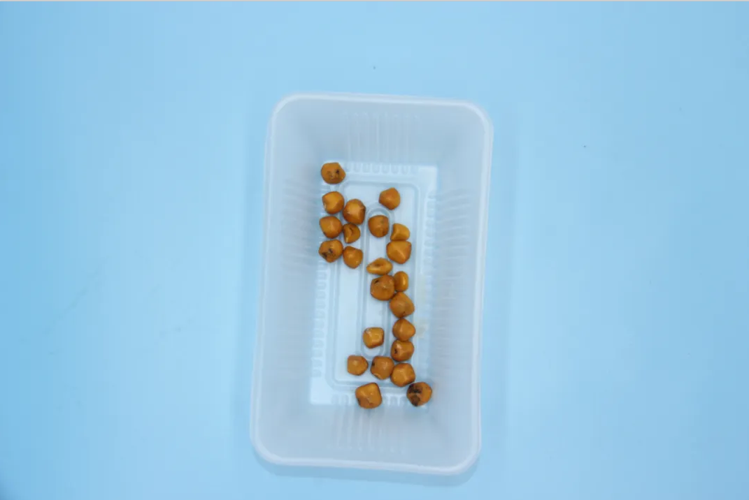 四川j结石病医院科普: 又到“胆结石高发季”!患者该怎么办?(图1) 四川j结石病医院科普: 又到“胆结石高发季”!患者该怎么办?(图1)