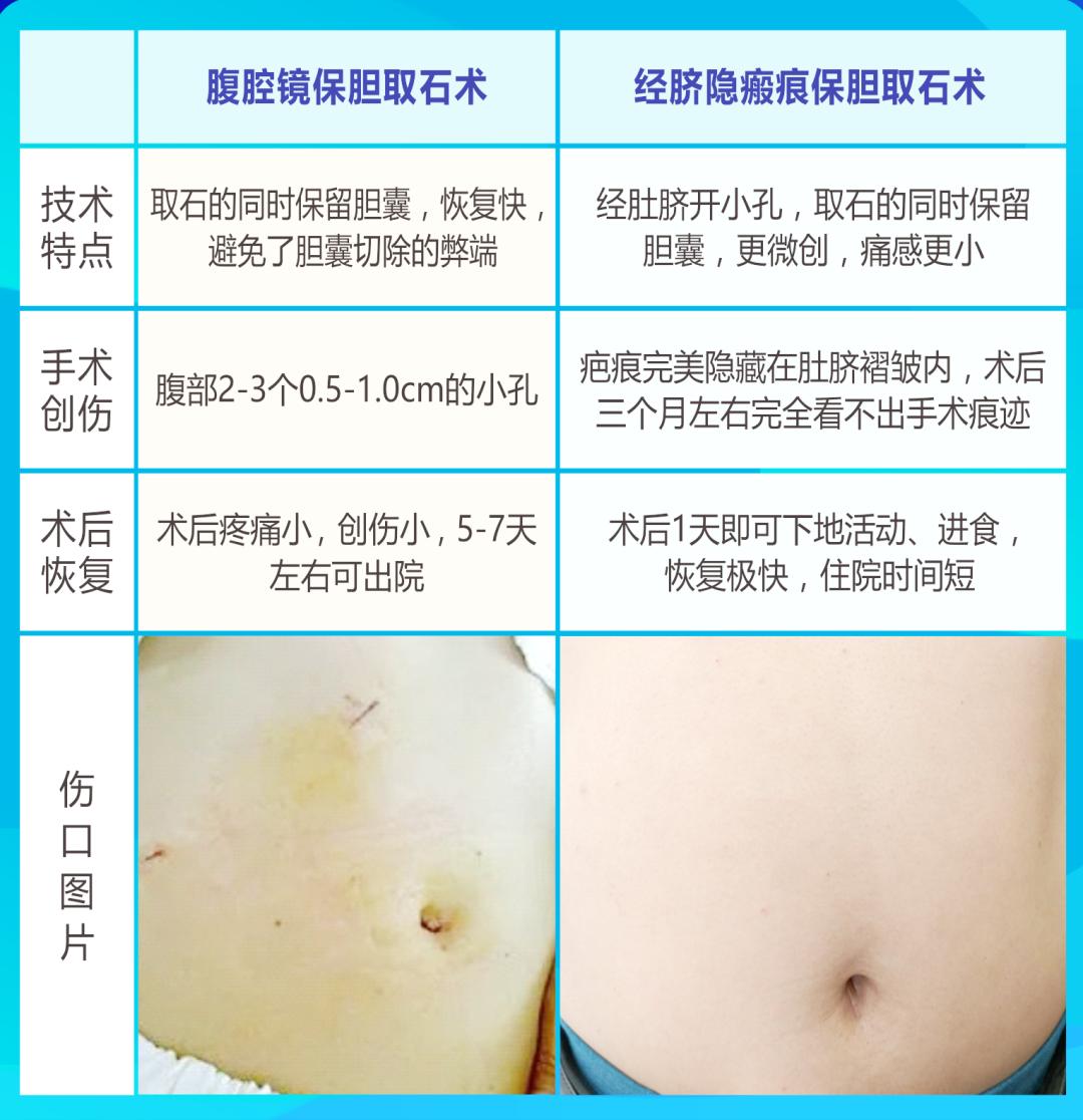 探访直击:四川结石病医院“隐形保胆”技术!「全国保胆取石基地」(图2) 探访直击:四川结石病医院“隐形保胆”技术!「全国保胆取石基地」(图2)