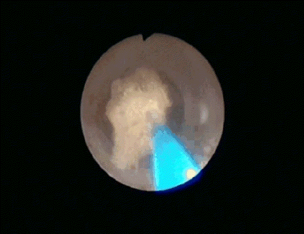 他们的五一，用坚守铸就劳动荣光【四川结石病医院】(图7)