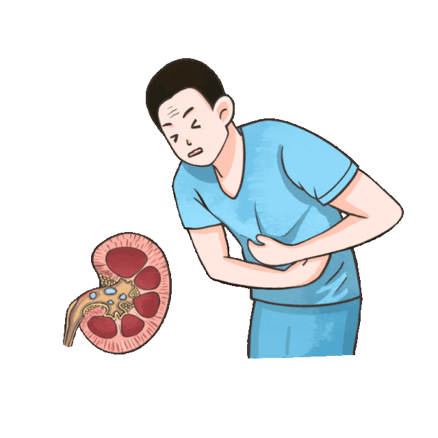 为什么有的人结石不痛，一查却很严重？四川结石病医院泌尿外科孙剑鸿主任详解(图2)