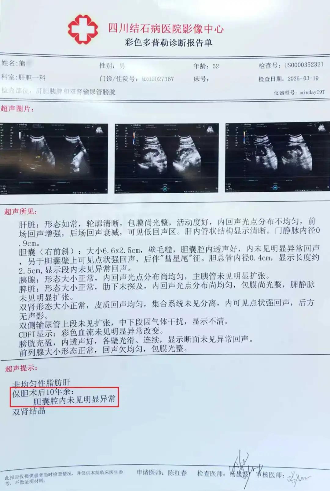 保胆10年，胆囊依旧完好！52岁患者亲身见证：保胆真的靠谱！(图1)