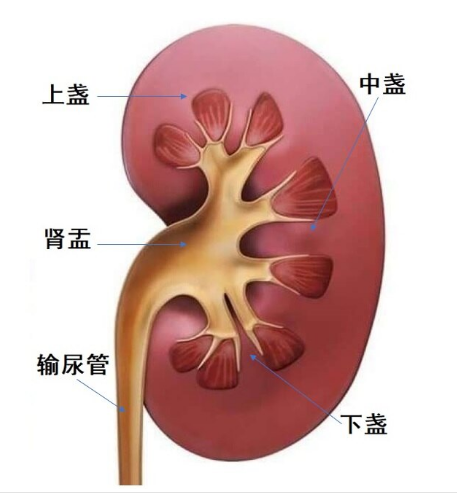 跳一跳就能排肾结石？别盲目跟风！这4种情况乱跳很要命(图3)
