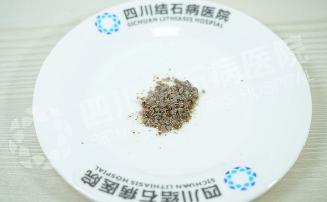 吓人！输尿管竟成“结石窝”！如何端掉这个“老巢”？【成都保肾取石医院】(图2)