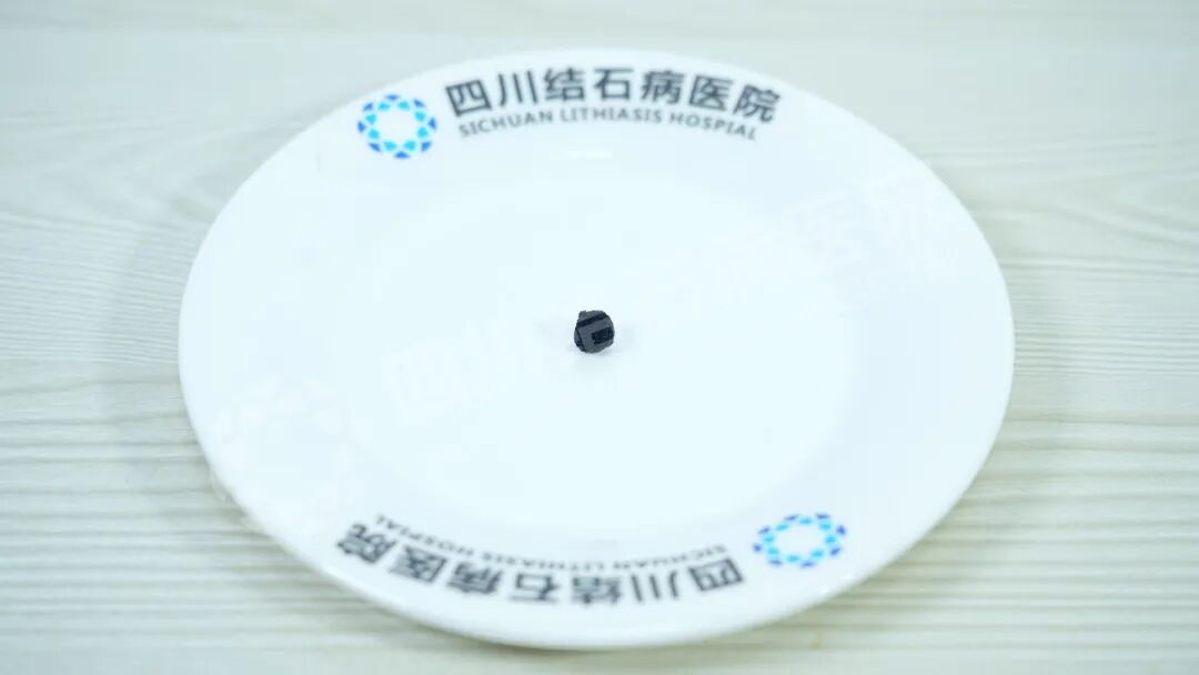 当三名合并严重疾病的患者遇结石，三台“硬仗”如何打赢？(图5)