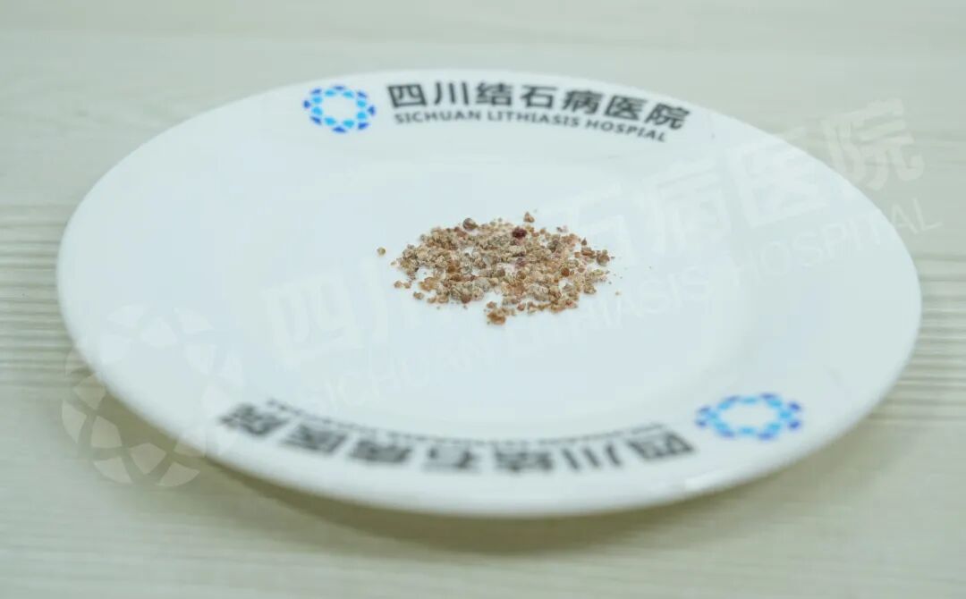 “到你们这当回家一样!”患者点赞四川结石病医院泌尿外科团队(图2) “到你们这当回家一样!”患者点赞四川结石病医院泌尿外科团队(图2)