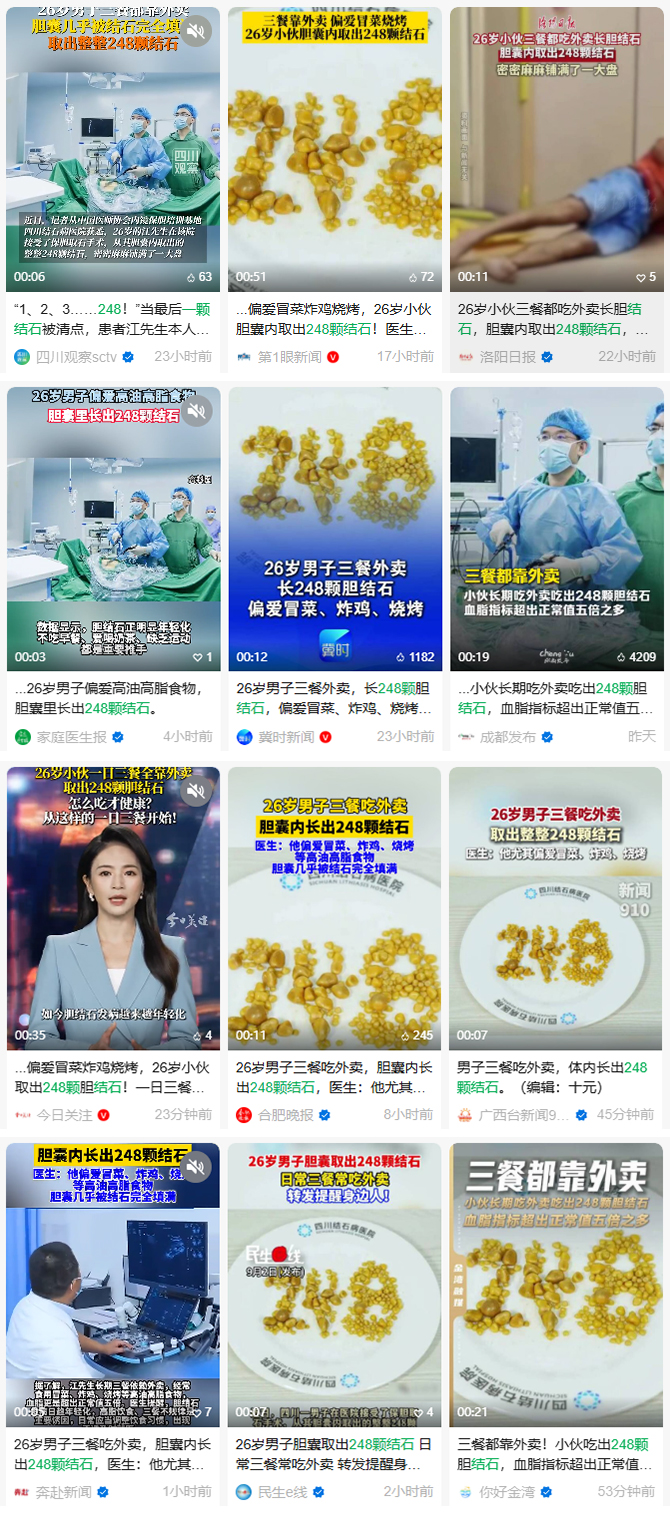 触目惊心!26岁上班族胆囊取出248颗结石,元凶竟是日常外卖(图1) 触目惊心!26岁上班族胆囊取出248颗结石,元凶竟是日常外卖(图1)